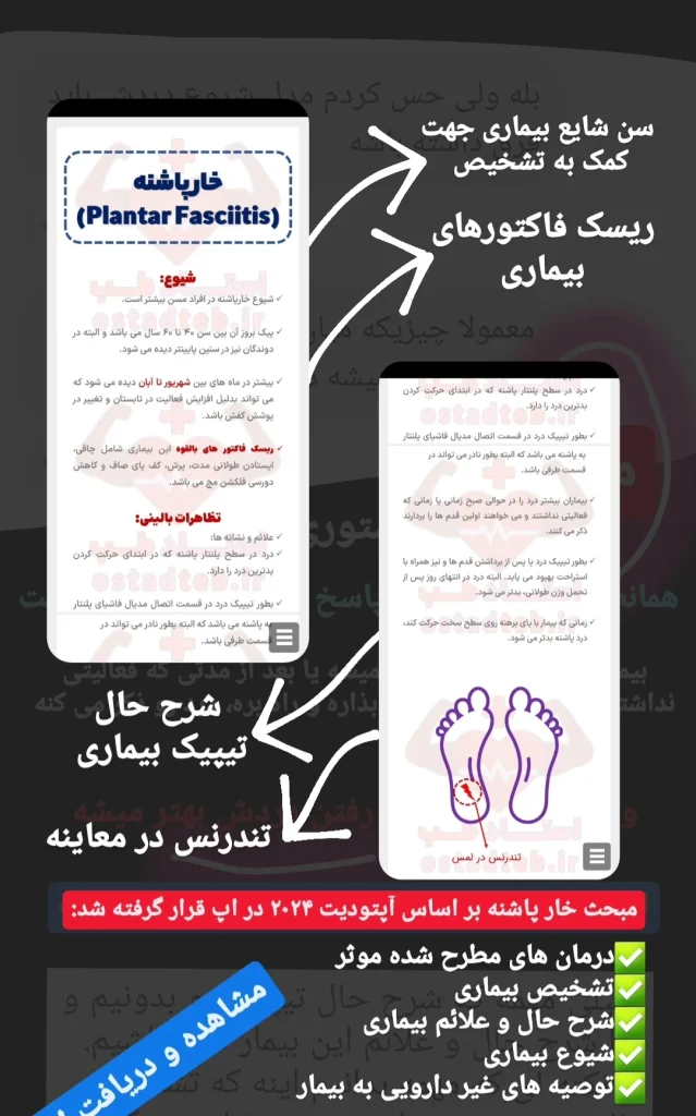 Plantar-fasciitis